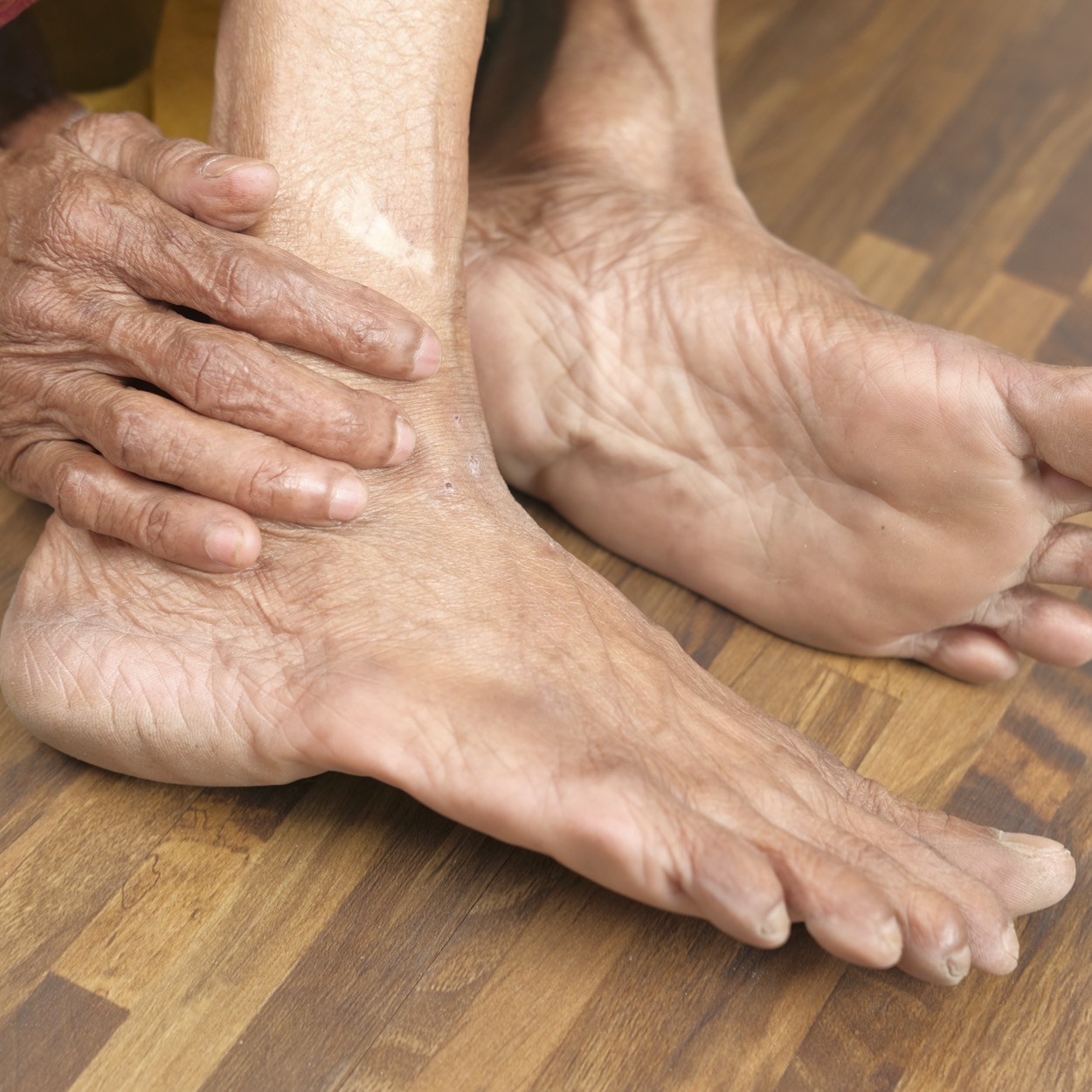 Foot representing nerve function and neuropathy evaluation.